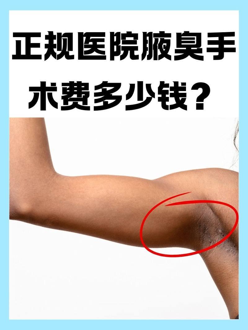 昆明狐臭医院哪家最专业?最新行业动态一览